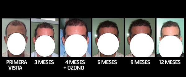 Centro capilar colombiano caso 2